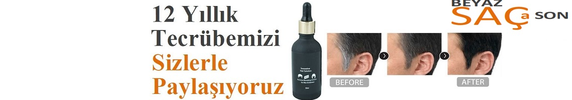 Beyaz Saça Son